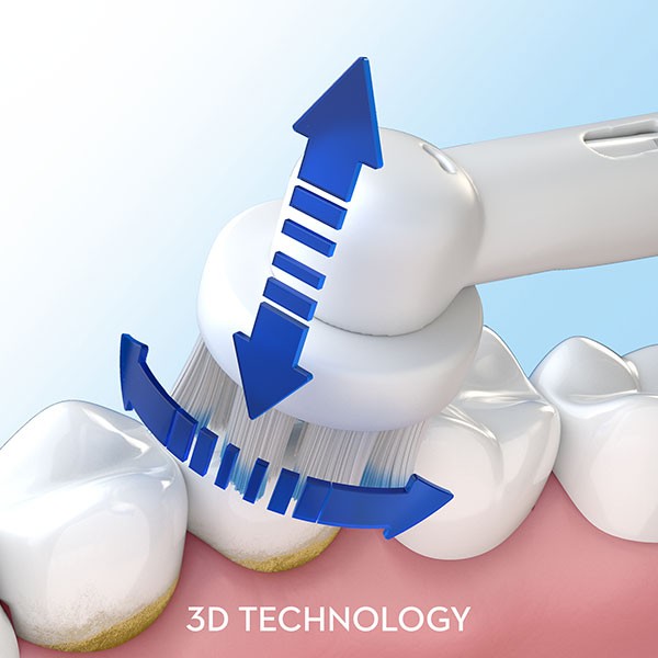 Oral B Cepillo de Dientes Eléctrico Profesional Cuidado Encías 1
